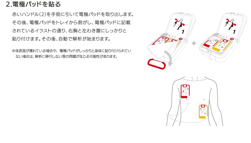 患者にペースメーカーが埋め込まれている場合